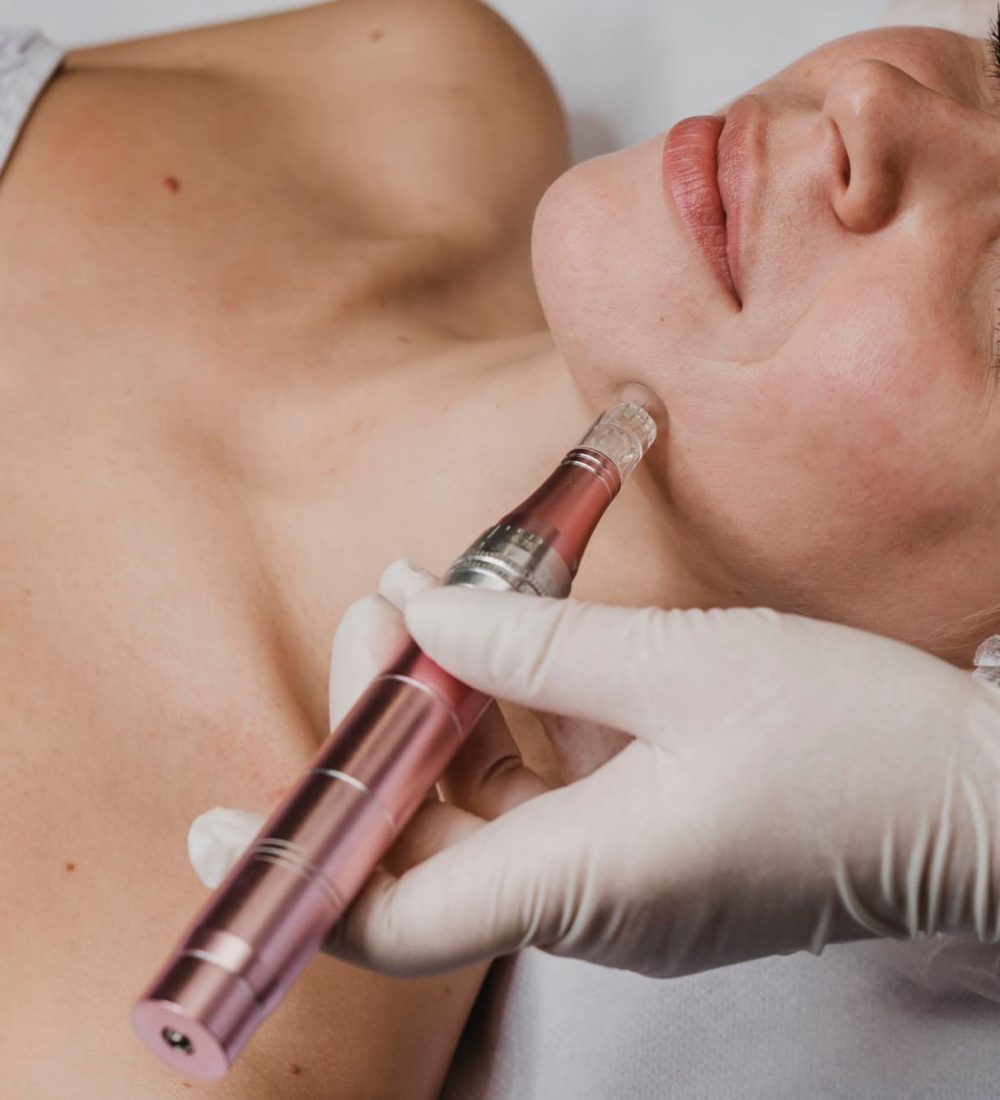 dermapen microneedling