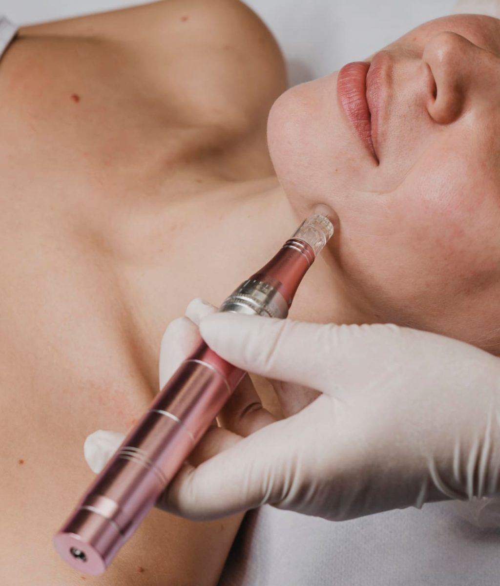 dermapen microneedling